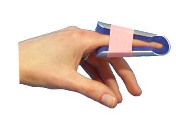 STECCA PER FRATTURA DITA A CAMPANA FARMASPLINT MISURA GRANDE PREFORMATA IN ALLUMINIO MODELLABILE CON IMBOTTITURA IN SPUGNA POLIURETANICA ANTIALLERGICA RADIOTRASPARENTE 15 CM - Farmafamily.it