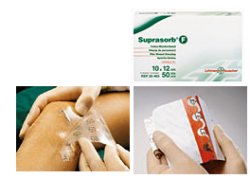 MEDICAZIONE STERILE IN FILM IN POLIURETANO TRASP. SUPRASORB F 10X12CM 10 PEZZI - Farmafamily.it