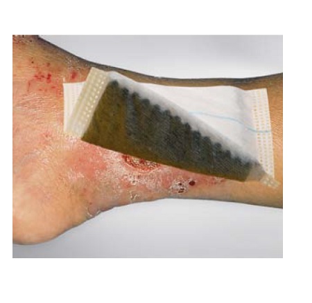 MEDICAZIONE IN TESSUTO NON TESSUTO AL CARBONE ATTIVO E ARGENTO COMPRESSA ASSORBENTE 10X10CM 10 PEZZI - Farmafamily.it
